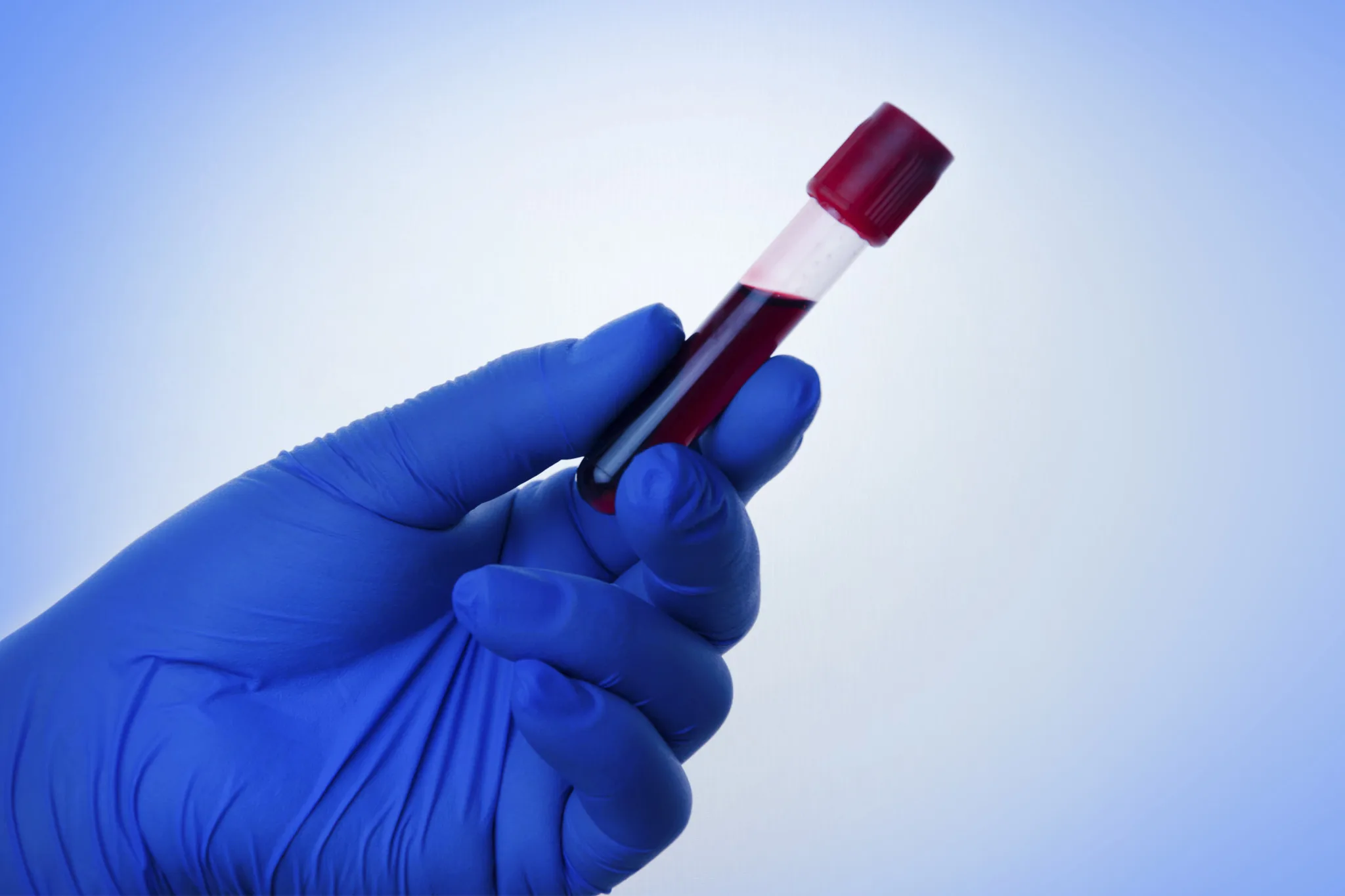 Hand,Of,A,Doctor,Holding,A,Bottle,Of,Blood. Hand of a doctor holding a bottle of blood.